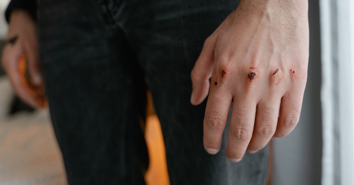 Horse Scratches Treatment Recipe